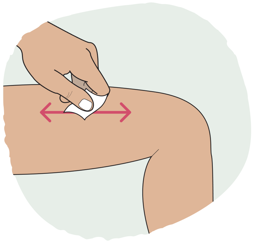 Illustration of injection site being cleaned with alcohol swab and red cap removed from Zembrace SymTouch